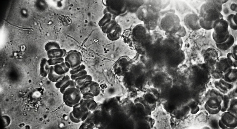 Blood cells before grounding